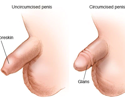 最新包皮环切手术治疗技术进展及优势深度解析